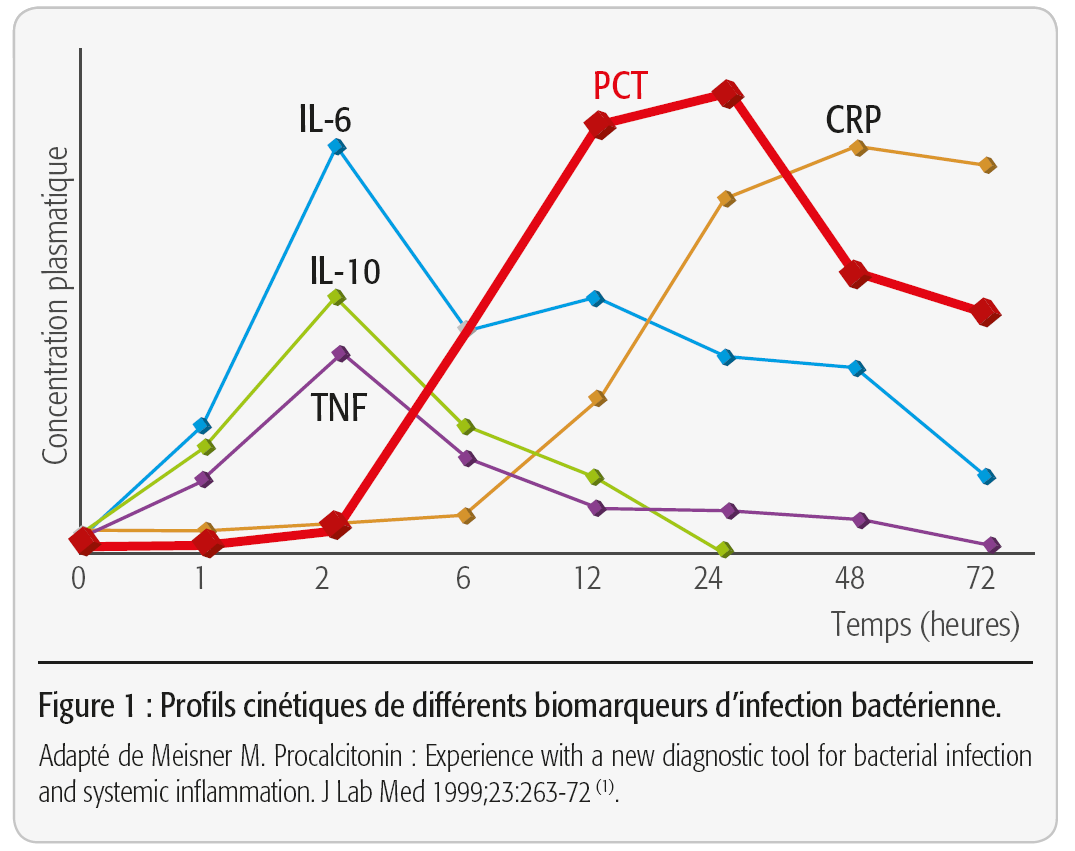 Profils cinétiques de différents biomarqueurs d'infection bactérienne