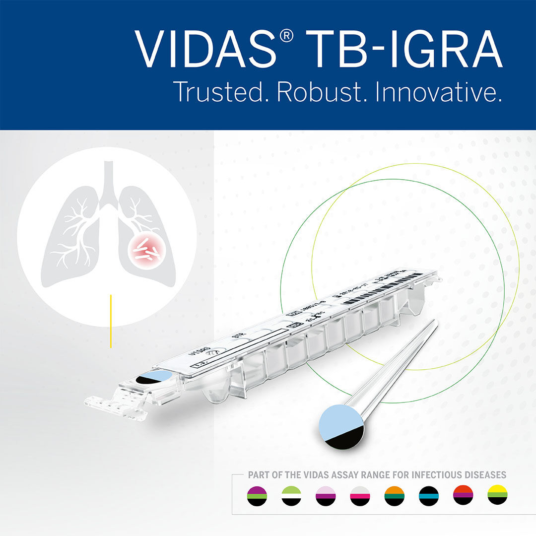 VIDAS® TB-IGRA - Diagnostic Clinique