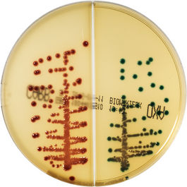 CHROMID CARBA SMART - Détection des Entérobactéries Productrices de Carbapénèmases (EPC)