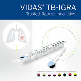 VIDAS® TB-IGRA